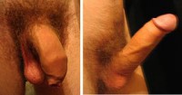 Erectie